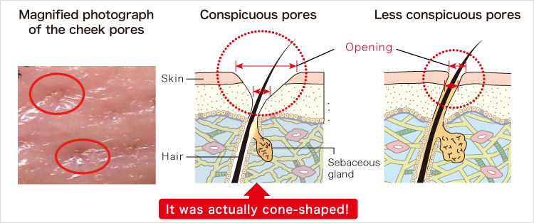 Magnified photograph of the cheek pores Conspicuous pores Less conspicuous pores