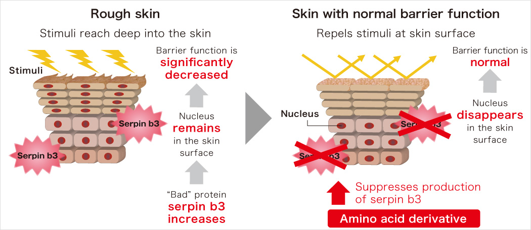Rough skin Skin with normal barrier function