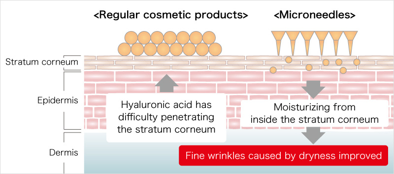 Regular cosmetic products Microneedles