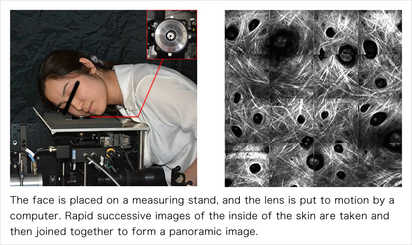 The face is placed on a measuring stand, and the lens is put to motion by a computer. Rapid successive images of the inside of the skin are taken and then joined together to form a panoramic image.
