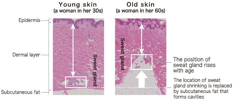 Young skin (a woman in her 30s),Old skin (a woman in her 60s)