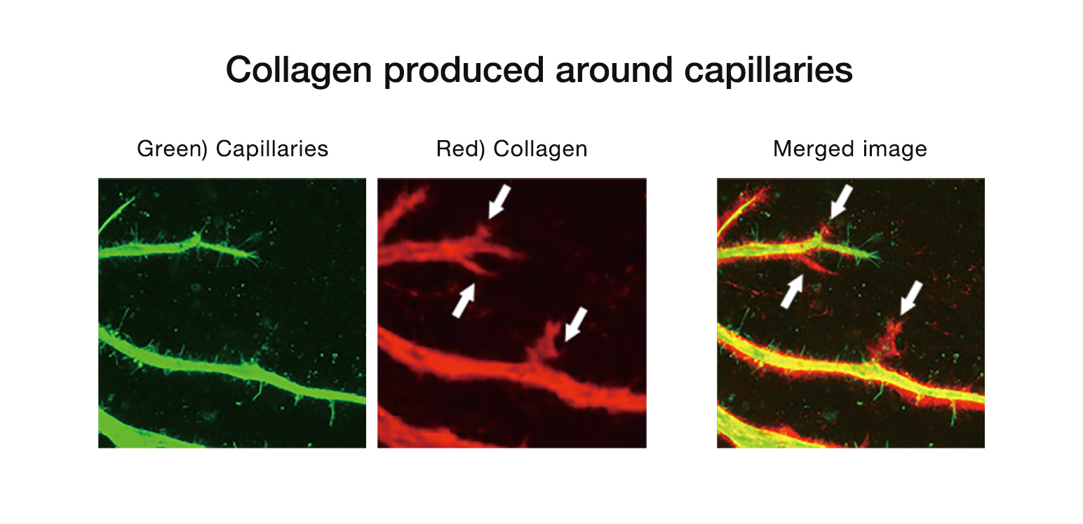 Collagen produced around capillaries