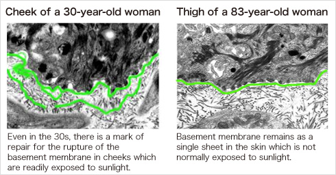 Cheek of a 30-year-old woman Thigh of a 83-year-old woman