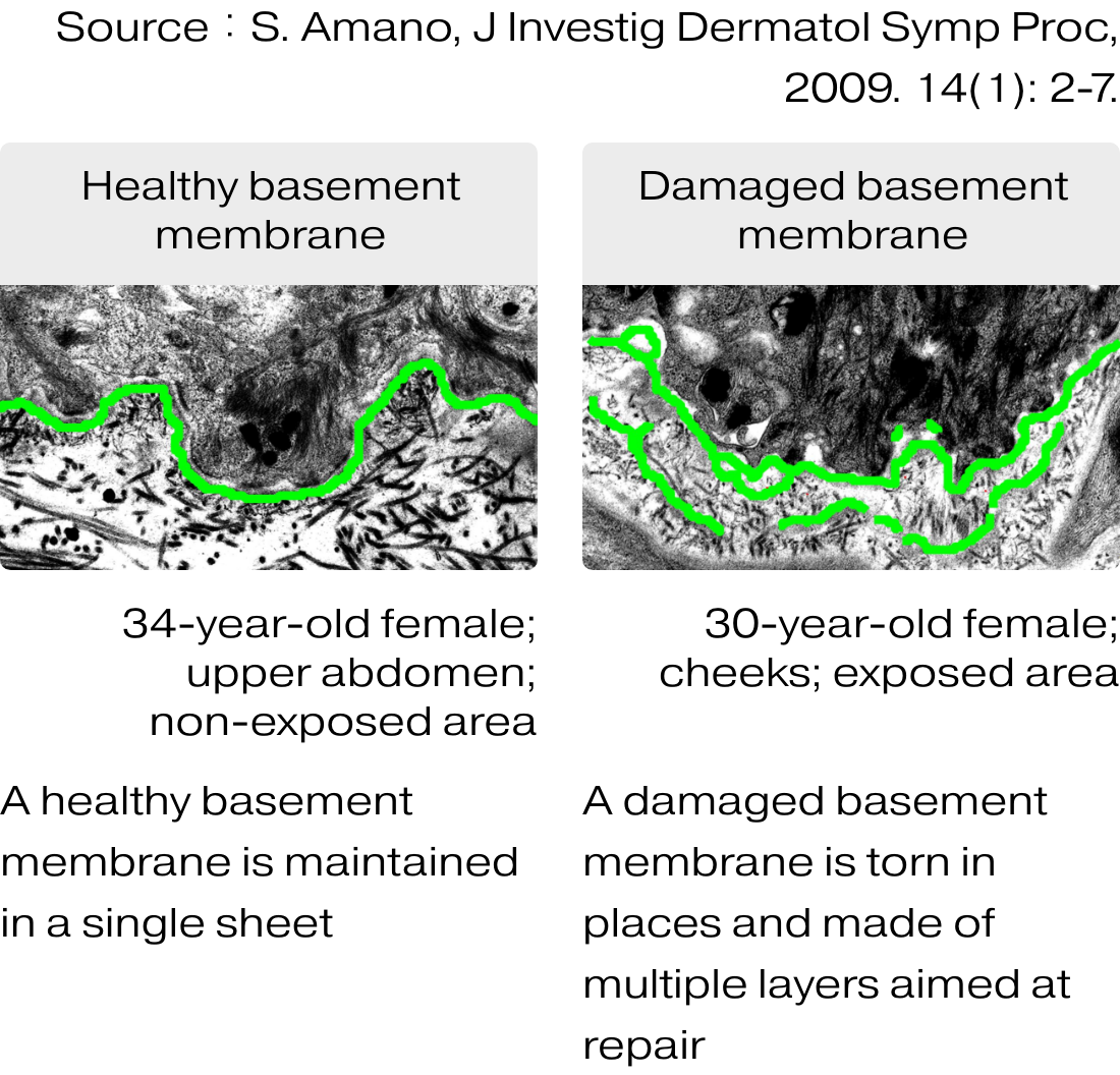 Shiseido focused on basement membrane research, and clarified that it is closely related to skin aging.