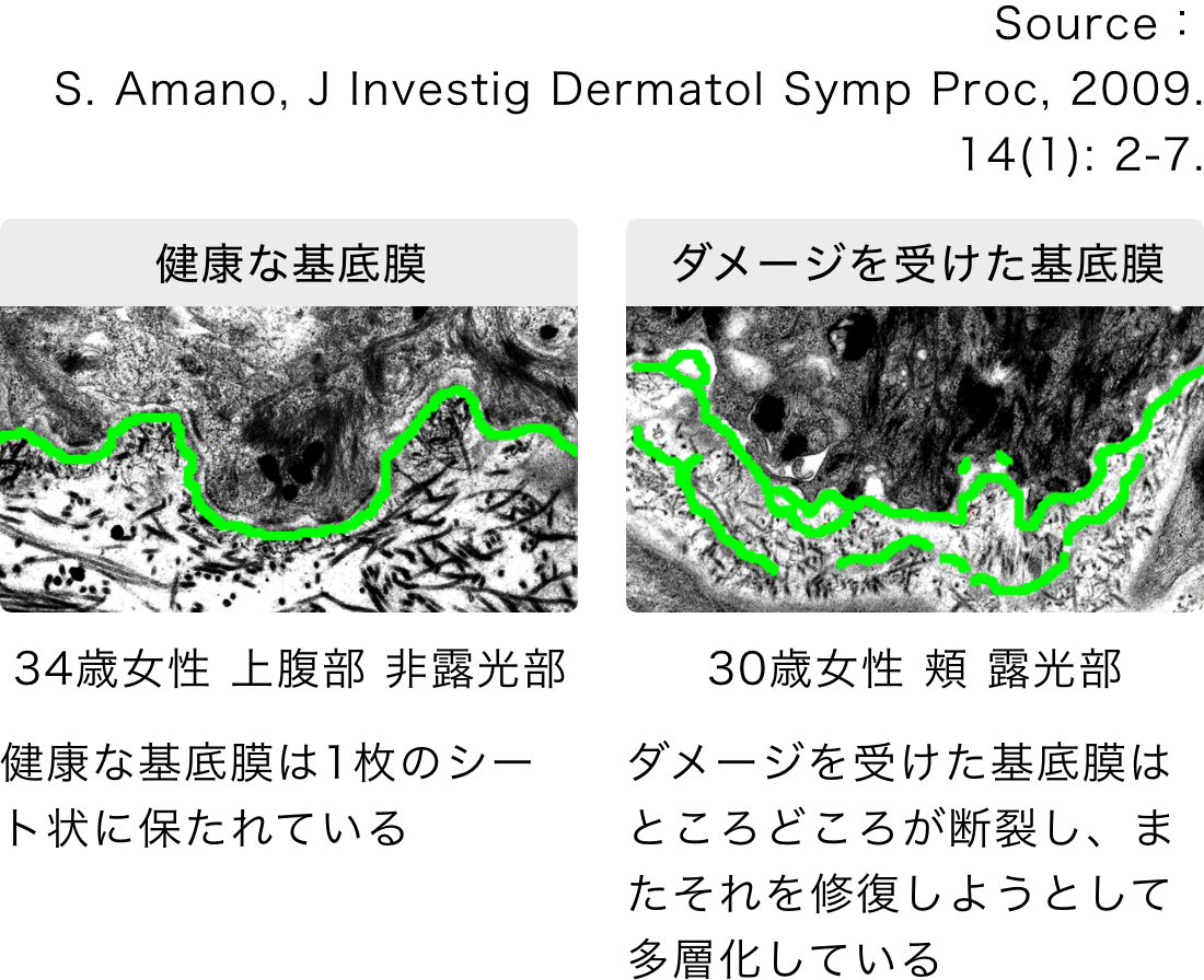 基底膜の研究に注力し基底膜が肌老化と密接にかかわっていることを解明。