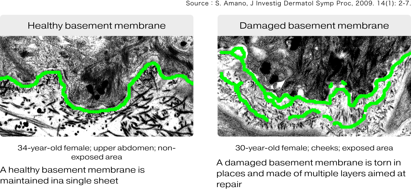 Shiseido focused on basement membrane research, and clarified that it is closely related to skin aging.