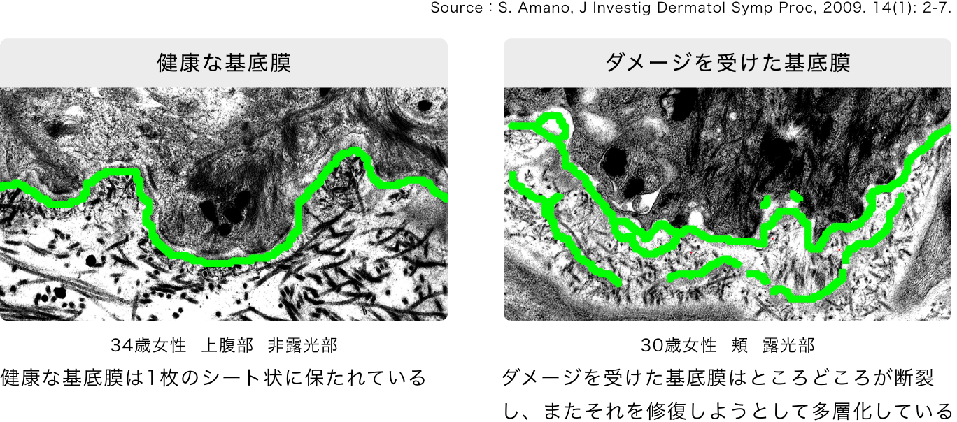 基底膜の研究に注力し基底膜が肌老化と密接にかかわっていることを解明。