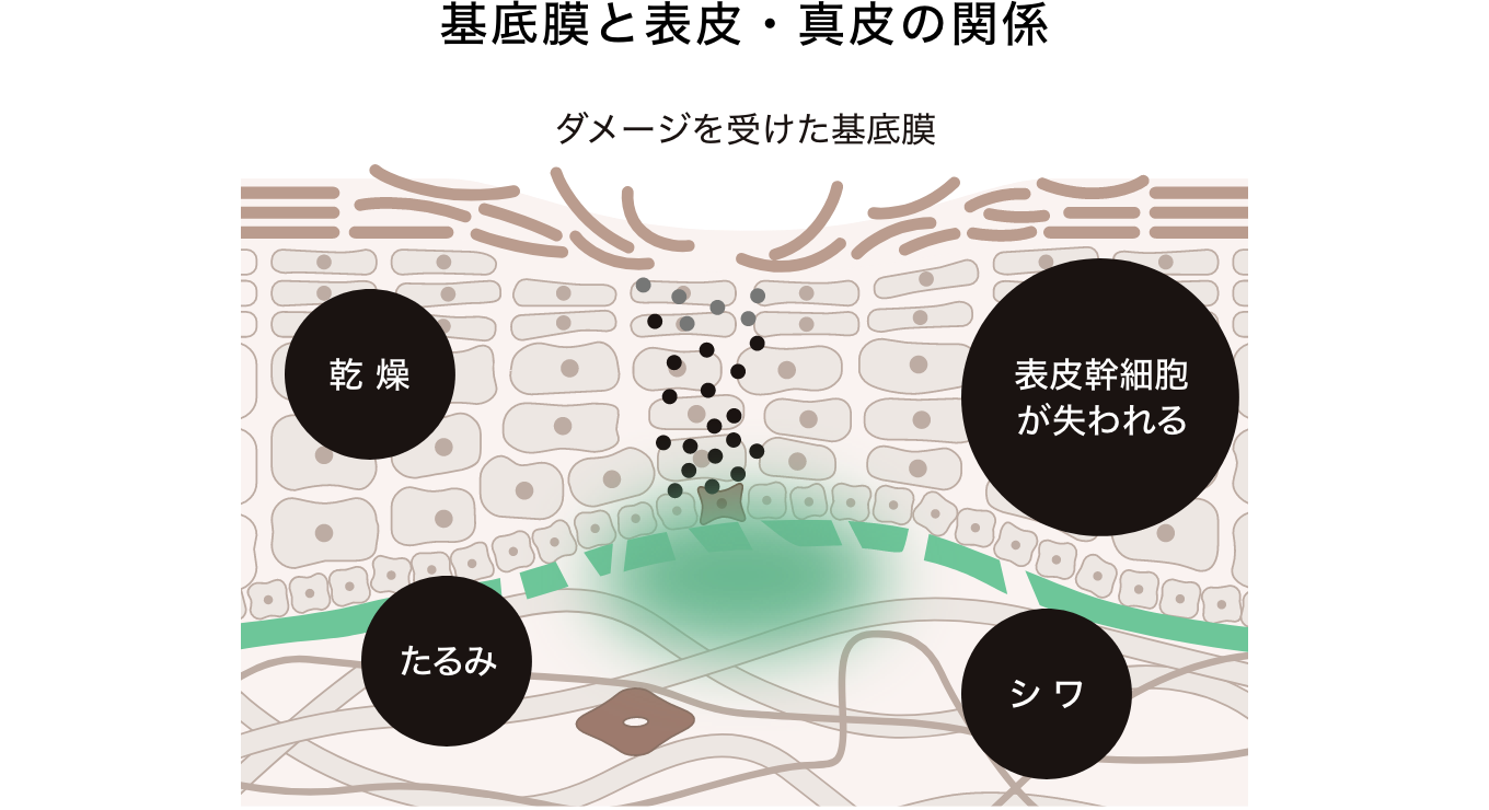 これらの発見から、「基底膜は肌のエイジングに大きく関与していた！