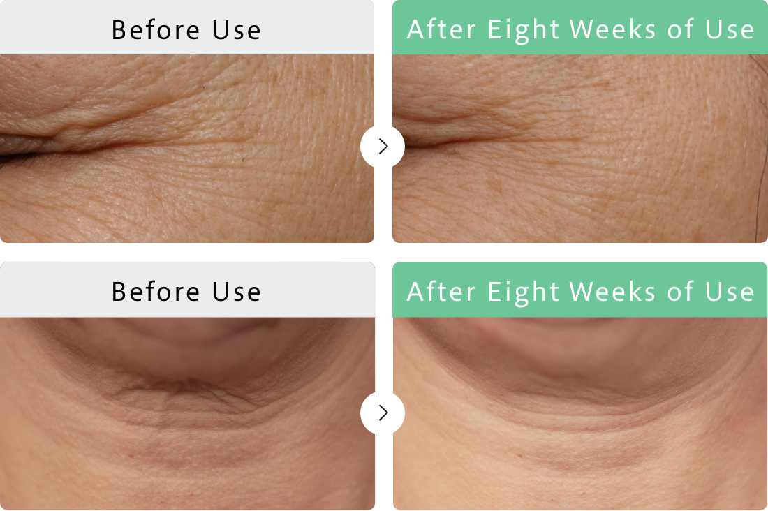 Continued use for eight weeks improves wrinkles Pure Retinol has positive effects on wrinkles around the eyes and on the neck.