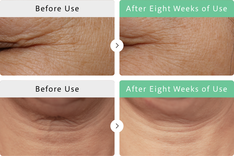 Continued use for eight weeks improves wrinkles Pure Retinol has positive effects on wrinkles around the eyes and on the neck.
