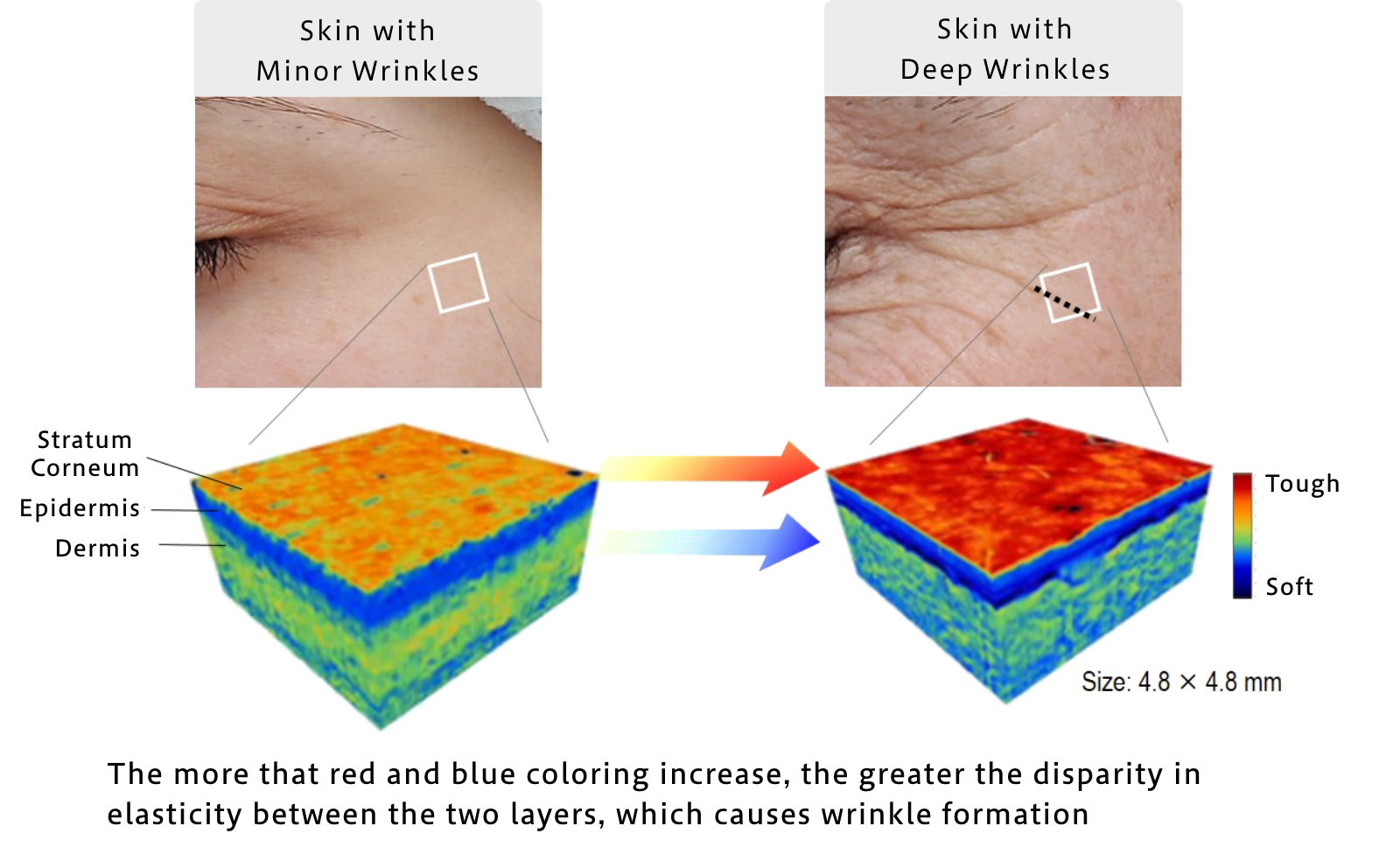 Shiseido’s world-first technology has enabled discovery of the “root causes behind wrinkles.” When the skin’s stratum corneum layer becomes too hard, it puts a burden on the dermal layer below, leading to wrinkle formation.