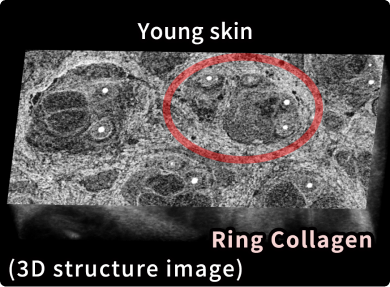 The structure of Ring Collagen deteriorates with age.