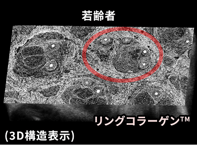 皮膚の中で収縮する力を生み出すリング状のコラーゲン構造 若齢者