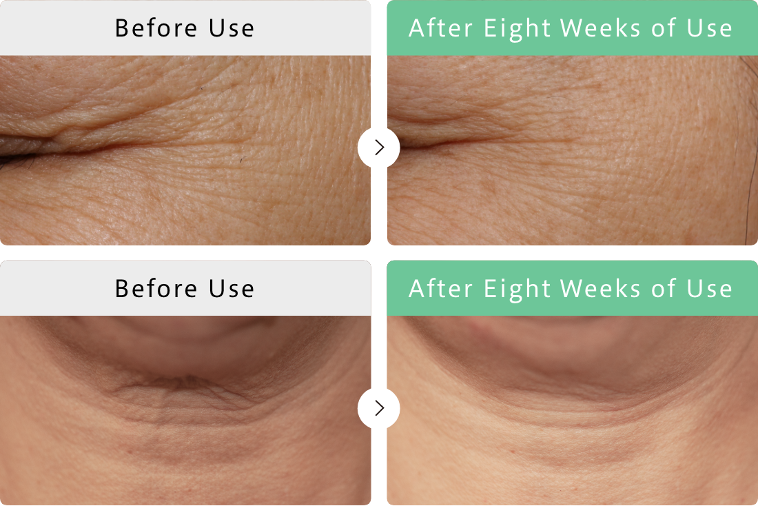 Continued Use for Eight Weeks To Improve Wrinkles