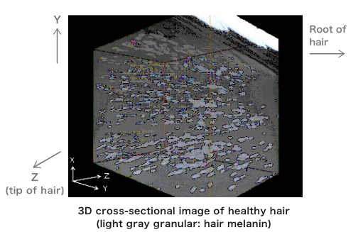 3D cross-sectional image of healthy hair (light gray granular: hair melanin) 