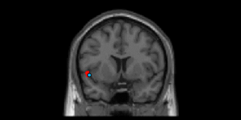 fMRI image