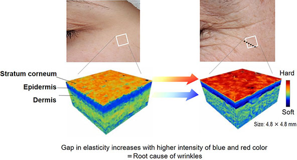 Occurrence of elasticity gap between stratum corneum and dermis