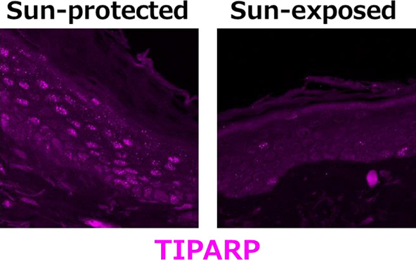TIPARP expression is reduced at Sun--exposed area