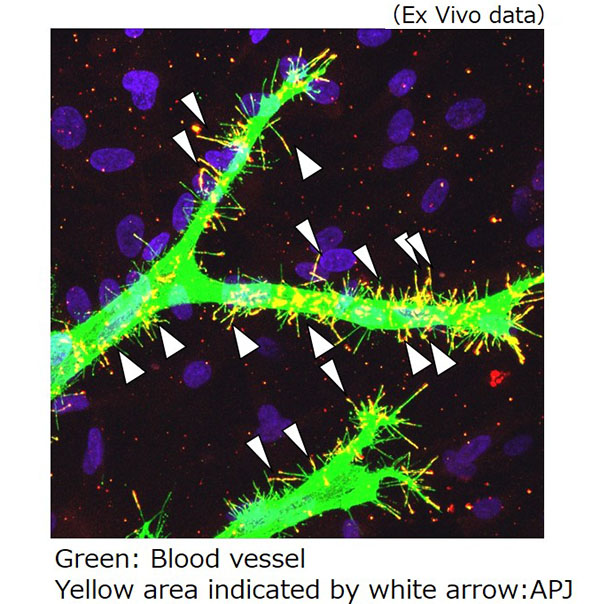 Softness sensor APJ in capillaries