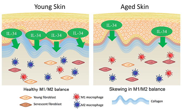 IL-34 downregulation skews macrophage balance.