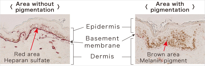 Area without pigmentation Area with pigmentation