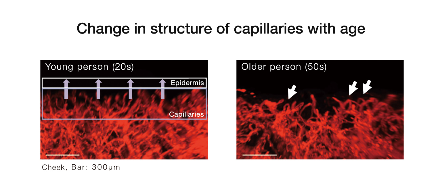 Change in structure of capillaries with age