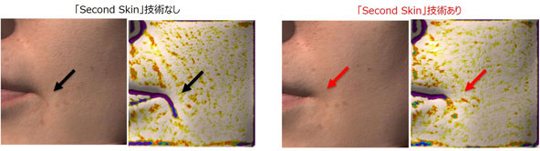 頬（マリオネットライン）の即時形状補正効果（メイクアップ効果によるもの）（右側：ANTERAで撮影）