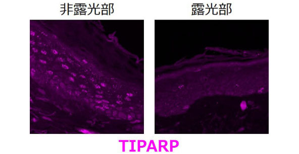 紫外線があたる部位では「TIPARP」の発現が減少する