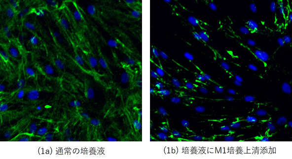 コラーゲン繊維形成にマクロファージM1の培養上清が与える影響（青：繊維芽細胞の核、緑：Ⅰ型コラーゲン）