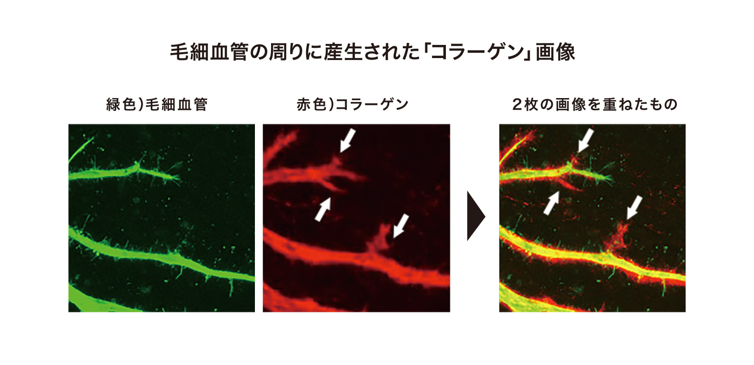 毛細血管の周りに産生された「コラーゲン」画像
