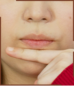 写真1 利き手反対側の人さし指を下唇の輪郭に添える