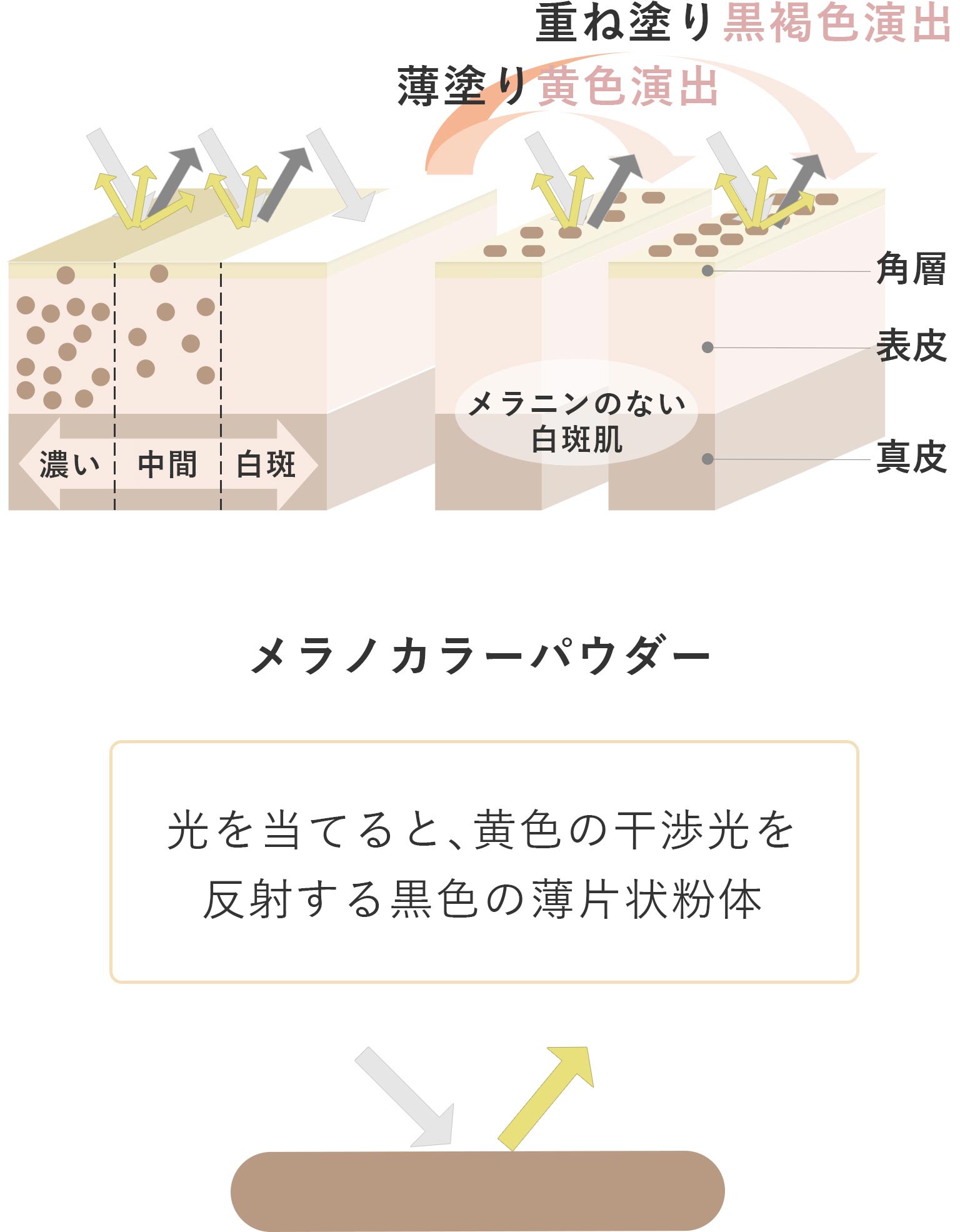 白斑部分に不足した「メラニン由来の色調」を演出する 新・光技術